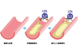 aggravateのイラスト