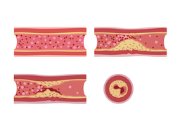 cholesterolのイラスト