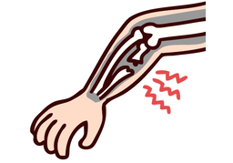 fractureのイラスト