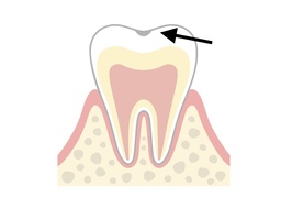incipientのイラスト