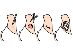 surgeryのイラスト